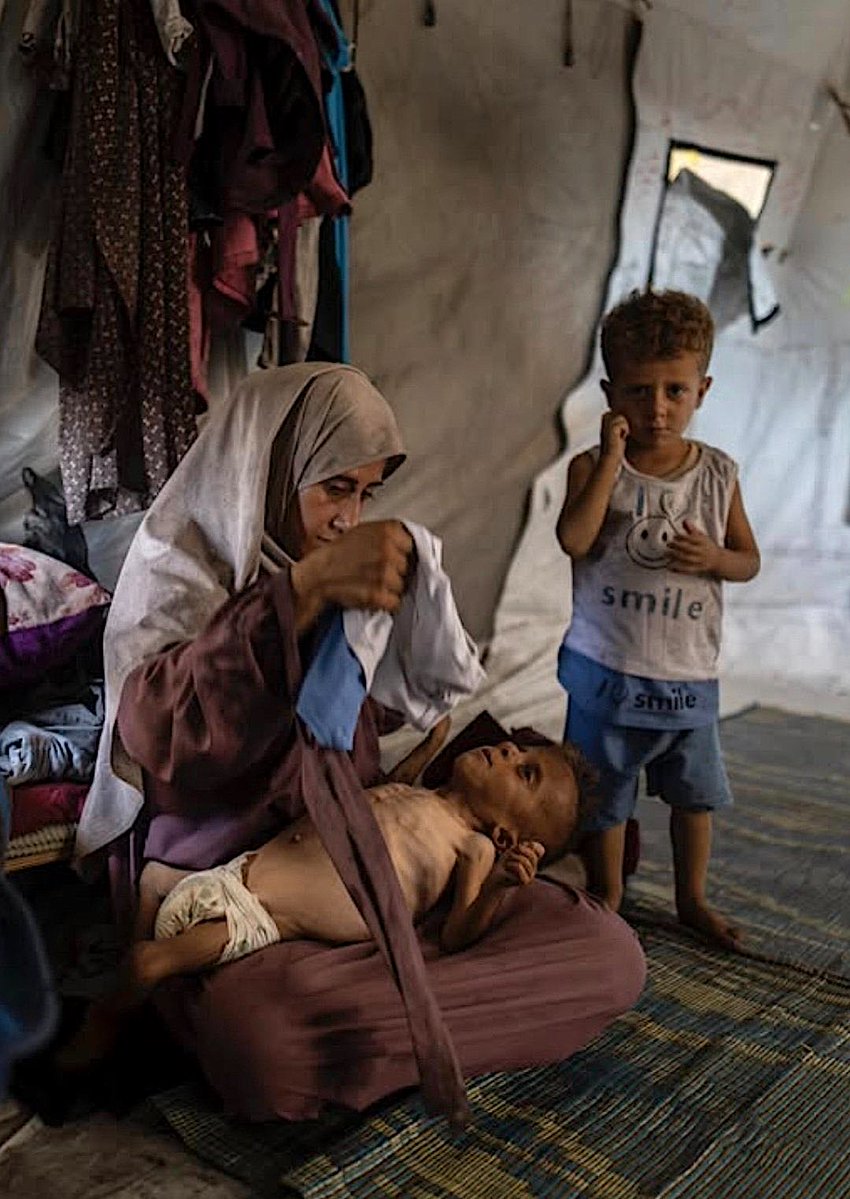 Como fabricar um ‘genocídio’ e milhares de crianças a morrer de fome? Esta é a capa do New York Times e a criança que a mãe segura nos braços chama-se Mohammed Zakaria al-Mutawaq e tem 18 meses. A criança nasceu com um distúrbio genético grave, doença muscular degenerativa,