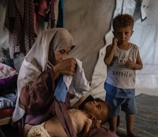 Halte à la Connerie (@halteconnerie) on Twitter photo 🔴Si vous voulez savoir à quel point les médias sont de parti pris sur Gaza (voire nous mentent), lisez le 🧵magistral ci-dessous de <a href="/mishtal/">David Collier</a>
Cette photo en une du Daily Express a fait le tour du monde. Elle montre un enfant avec une maladie congénitale, pas un enfant affamé. 🔴Si vous voulez savoir à quel point les médias sont de parti pris sur Gaza (voire nous mentent), lisez le 🧵magistral ci-dessous de <a href="/mishtal/">David Collier</a>
Cette photo en une du Daily Express a fait le tour du monde. Elle montre un enfant avec une maladie congénitale, pas un enfant affamé.
