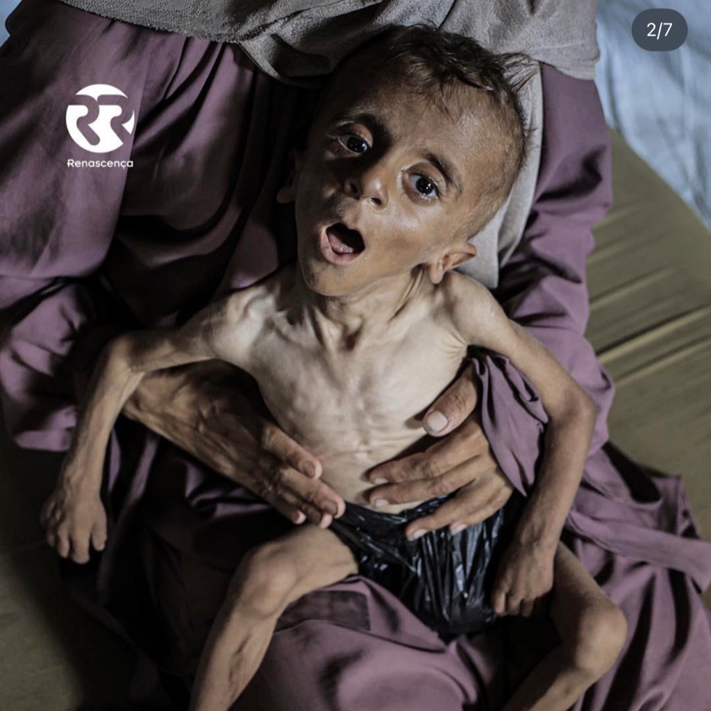 🚨AGORA: Papa Leão XIV critica Israel pela primeira vez e denuncia crianças morrendo de fome em Gaza.