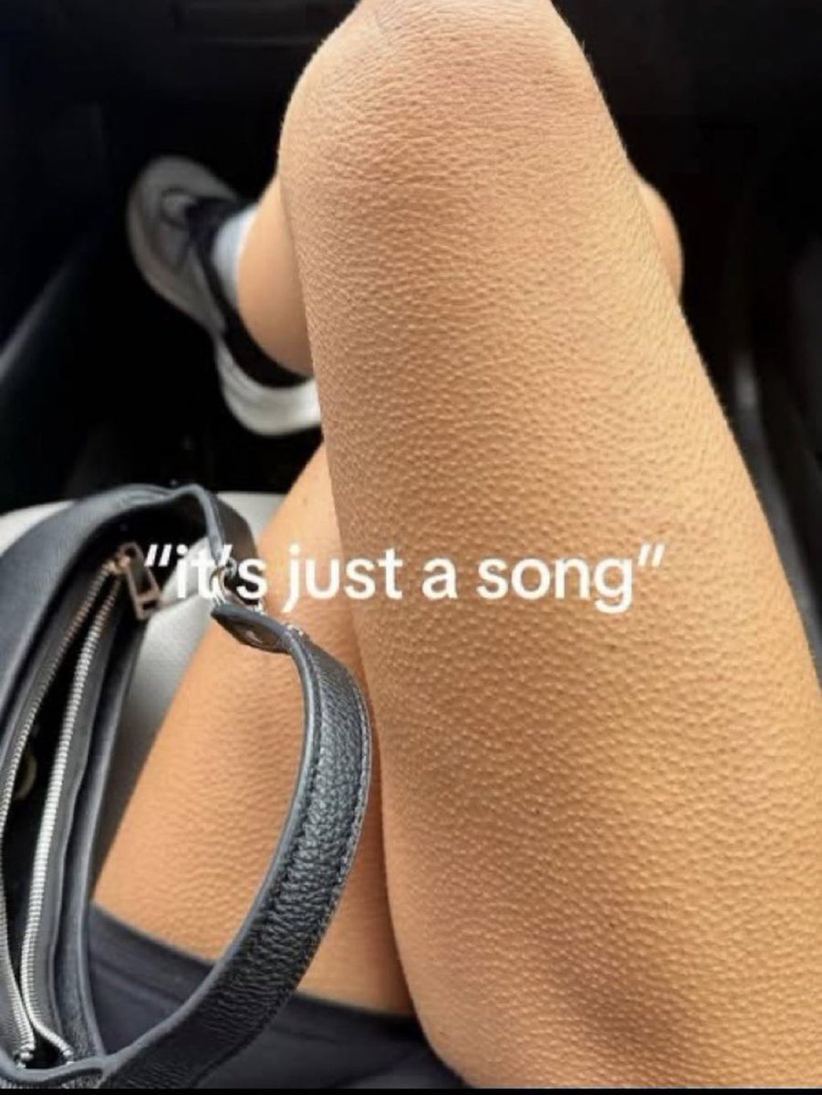 glittersnot's tweet image. what gaga song is this