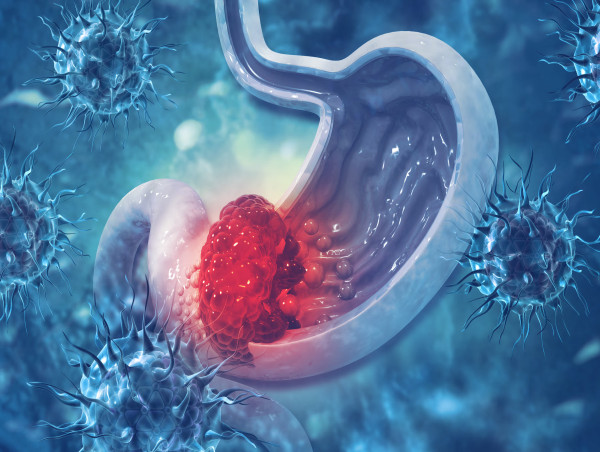 The HER2+ gastric cancer therapy market is set to hit $2B by 2033, thanks to breakthrough therapies and major US/Japan investment fueling global advancements.  kalkinemedia.com/news/world-new…