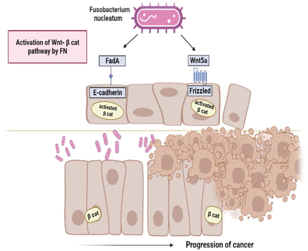 Micro_MDPI's tweet image. 🦠This paper focuses on the role of the oral bacterium Fusobacterium nucleatum in the development and progression of certain human cancers, particularly oral squamous cell carcinoma and colorectal cancer.
🔎Read more at: mdpi.com/2076-2607/11/9…
#oral #microbiota #cancer