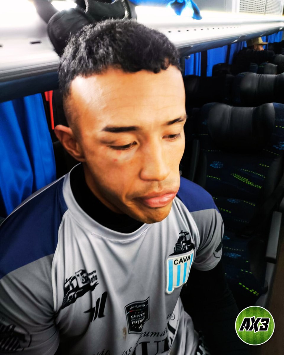 ElAscensox3's tweet image. 📸Imagenes de alguno de los jugadores de VICTORIANO ARENAS agredidos en cancha de Central Ballester.

Fede Ulayar, quien había sido hospitalizado, recibió suero y antibioticos y ya se encuentra con el plantel.

Luis Ventura, está en el Sanatorio Trinidad haciendose una…
