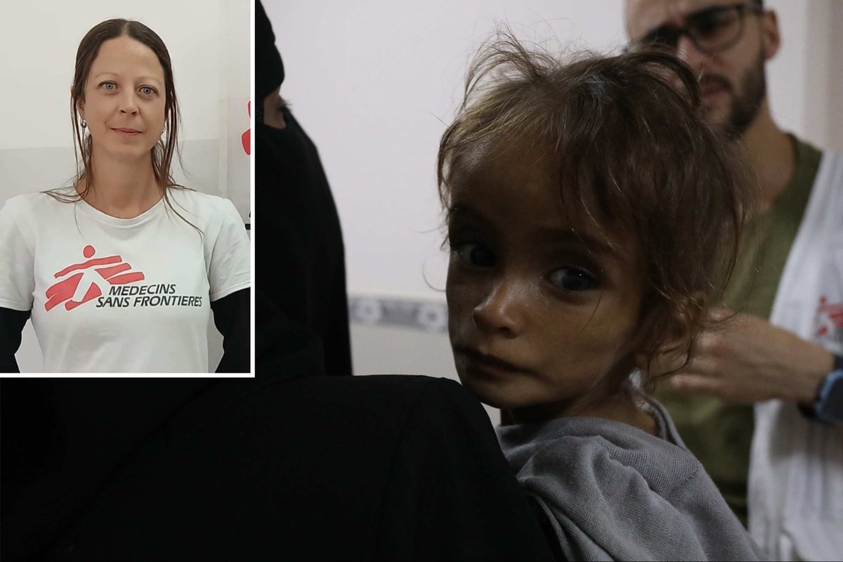 bobjcarr's tweet image. The face of a Palestinian child says it all. This is a man-made famine, as in the Warsaw Ghetto. This outweighs other diplomatic considerations. To recognise Palestine sends a message to Israel to let food through in adequate quantities or be further defined as a pariah, …