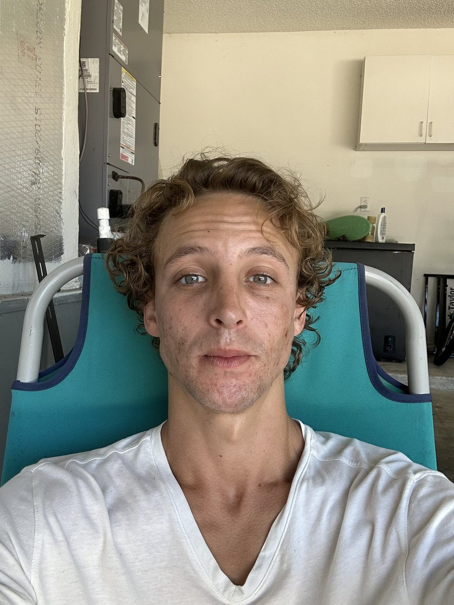 Jacktalksbackp's tweet image. What Jack the Frog really looks like! $XRPLOL to the Moon!!!
