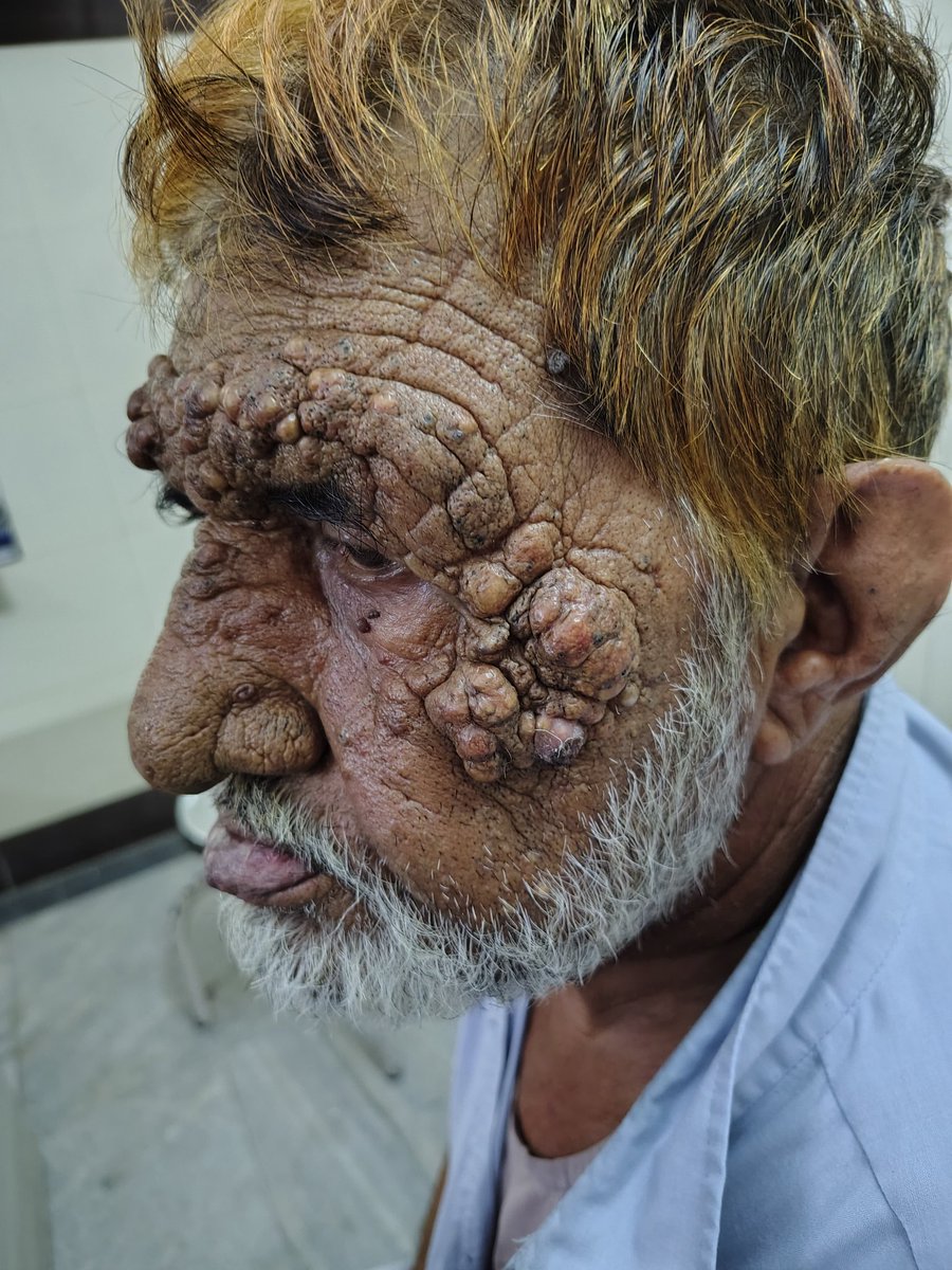Diagnosis...??
<a href="/neoskinhealer/">Dr. ISHWAR N RATHORE MD</a>