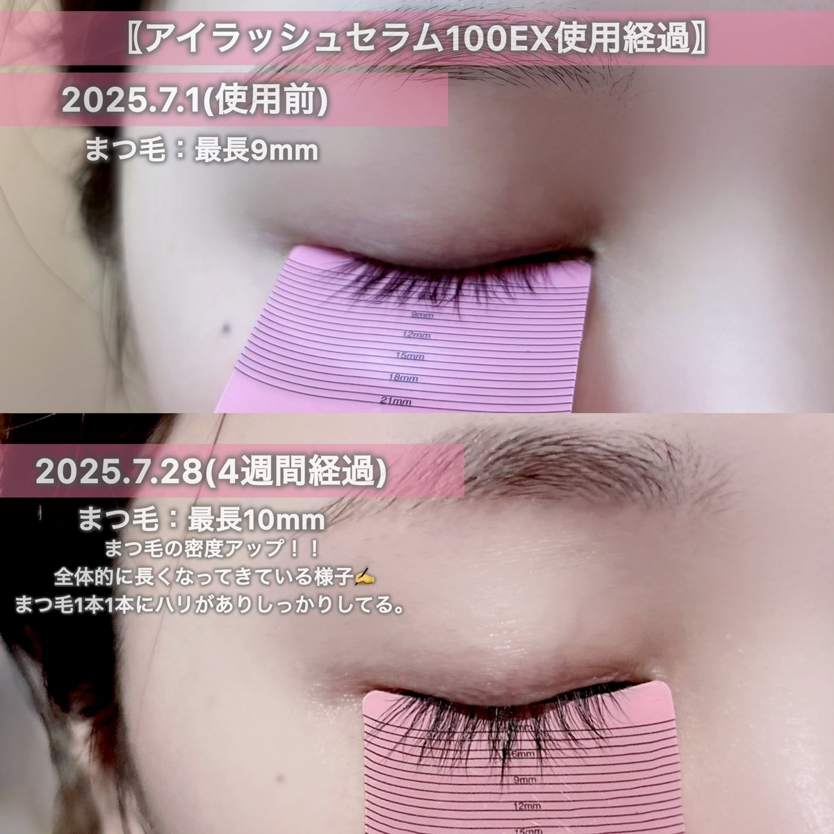 Lilium723's tweet image. COSNORI #コスノリ
〖アイラッシュセラム100EX使用経過🎀〗
根元から毛先までしっかりと栄養成分を補給･保湿。使用開始から染みたり痒みもなく使い心地良好◎まつ毛にハリが出てきて密度アップしてる🪄
使用前▷▶使用4週間後📷

#PR #2025コスノリアンバサダー1期 #アイラッシュセラム100EX…