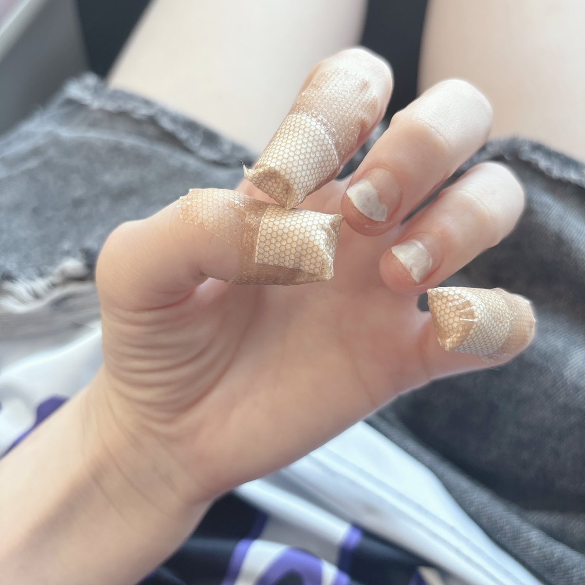 amexogog's tweet image. 今爪の状態が悪くてネイルお休み中🥹全部爪剥がれてて、絆創膏が足りない…！日本一絆創膏使ってる自身ある