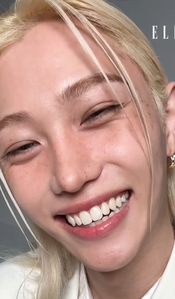 dailylixiee's tweet image. Fefi teeth having it’s own fandom &amp;gt; 
like I get it