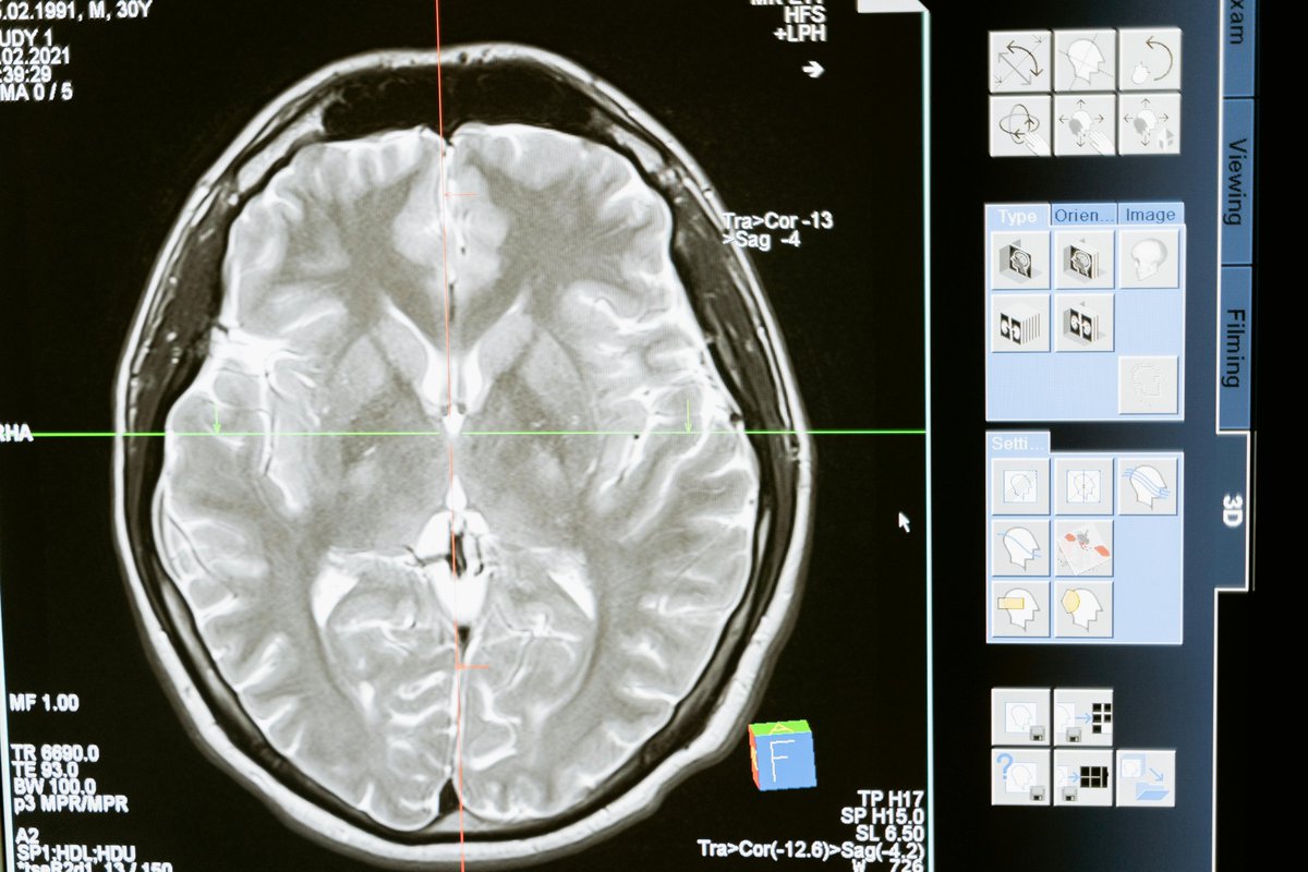 editorNRTimes's tweet image. Our members are redefining recovery, one insight at a time. Explore their stories and the impact they’re making in the field: aspectpublishing.shorthandstories.com/neuro-rehab-di…