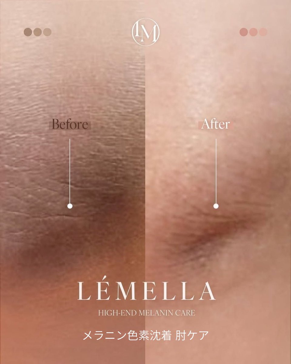LÉMELLA ボディクリーム ハイエンドメラニンケア ルメラジャパン｜Lémella japan (@lemella.jp) · Instagram