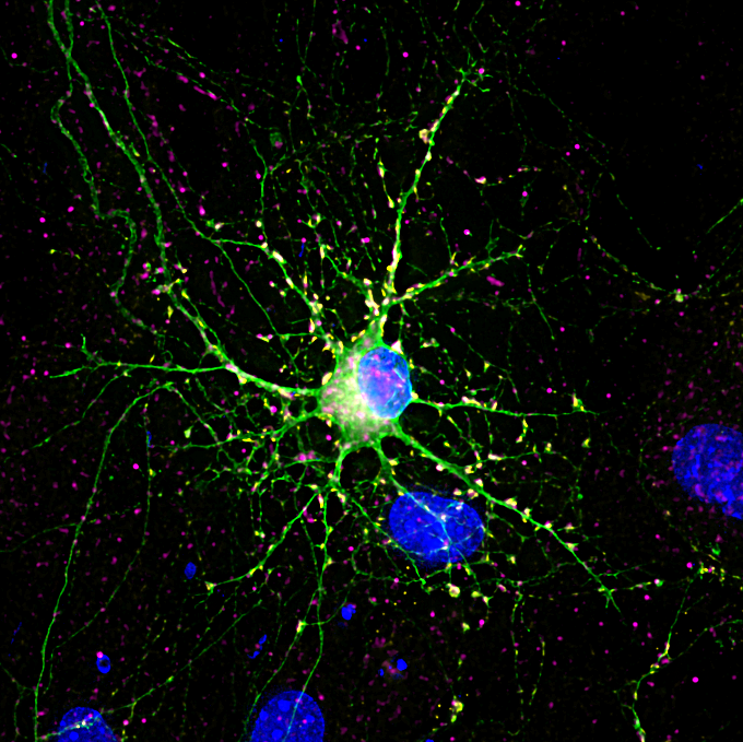 Instituto de Neurociencias UMH-CSIC (@neuroalc) on Twitter photo #SciencePhoto_IN
“Stranger in a Strange Land”
Author: Dr. Emily Wilson <a href="/emily_wilson9/">Emily Wilson, Ph.D.</a>
Lab: Dr. Guillermina López Bendito <a href="/GLB_Lab/">Lopez_Bendito Lab</a>
"A thalamic neuron (green) establishes synaptic connections (yellow and magenta) in a field of cortical astrocytes. Taken on <a href="/LeicaMicro/">Leica Microsystems</a> Thunder." #SciencePhoto_IN
“Stranger in a Strange Land”
Author: Dr. Emily Wilson <a href="/emily_wilson9/">Emily Wilson, Ph.D.</a>
Lab: Dr. Guillermina López Bendito <a href="/GLB_Lab/">Lopez_Bendito Lab</a>
"A thalamic neuron (green) establishes synaptic connections (yellow and magenta) in a field of cortical astrocytes. Taken on <a href="/LeicaMicro/">Leica Microsystems</a> Thunder."