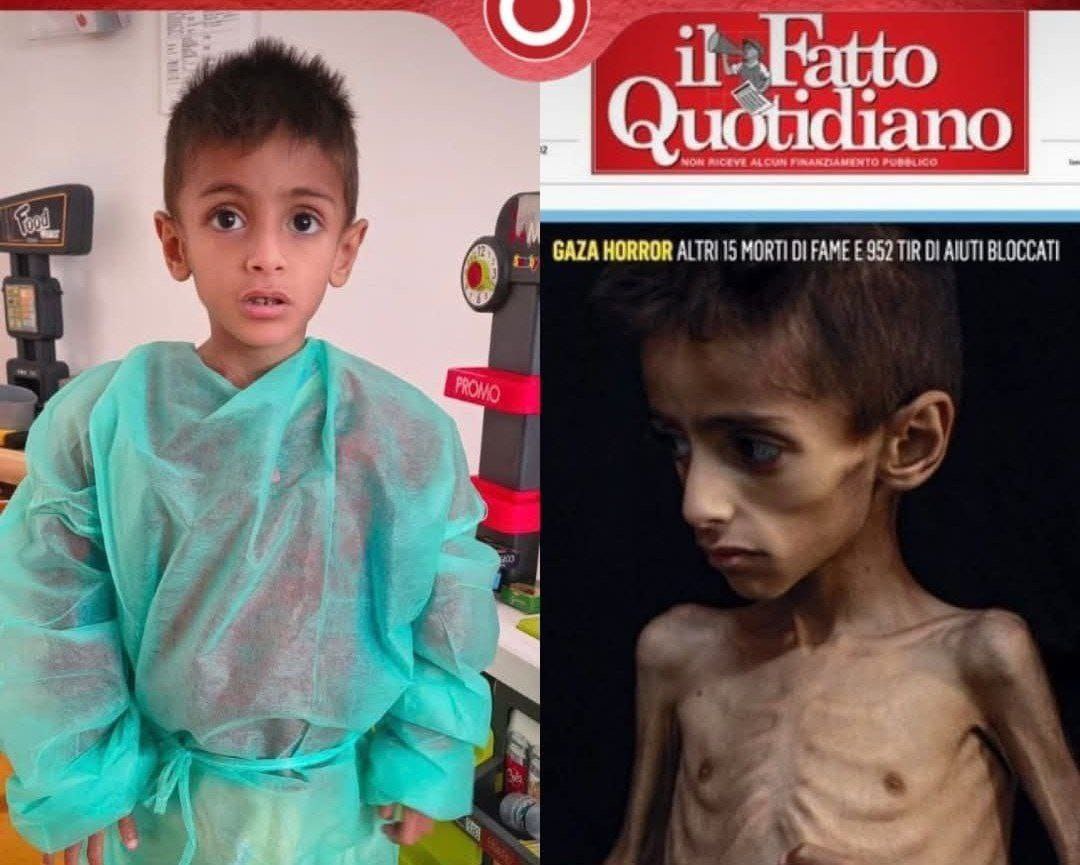 Wie sich inzwischen herausstellt ist mindestens eines der Kinder, dessen Fotos die Hamas für ihre "Hunger-Kampgne" missbraucht hat, seit 2 Monaten in Behandlung in Italien. Das Datum der Erstveröffentlichung muss nicht das Datum der Erstellung des Fotos sein.