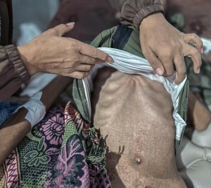 Today, the death toll from hunger in Gaza has risen to 86. 86 people who could have been saved with food, compassion, and action. My heart breaks. My little brother, malnourished, cries bitterly, looks at me and says, “Aya, I’m hungry.” I can’t describe the helpless feeling. His