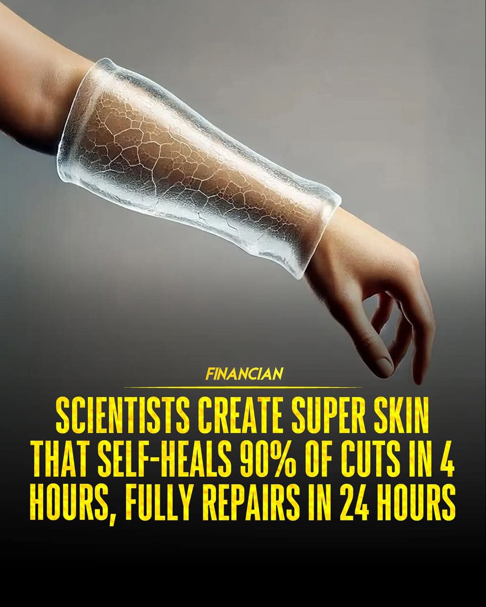 FirozL18701's tweet photo. *BREAKTHROUGH HYDROGEL* mimics *HUMAN SKIN*! Scientists from *AALTO UNIVERSITY* & *UNIVERSITY OF BAYREUTH* developed a material that *SELF-HEALS 90% IN 4 HOURS* — fully restored in *24 HOURS*.
#SmartMaterials #SelfHealing #HydrogelTech #BioInnovation #FinlandScience https://t.co/LjWOAegOTm
