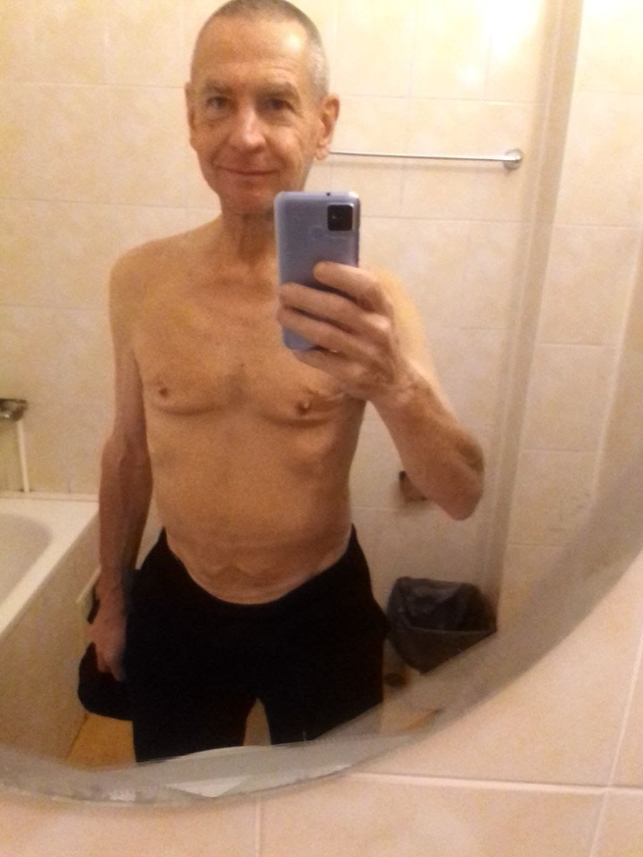 Valentyn – hrdina, který přežil ruské zajetí.
Dobrovolně šel bránit Ukrajinu. V květnu 2022 držel pozici ve skladu 72. brigády na Doněcku. Byl těžce zraněn a zajat. V zajetí strávil téměř 3 roky. Prošel peklem – ale přežil.

Jeho proměna před a po mluví za vše.
Teď potřebuje