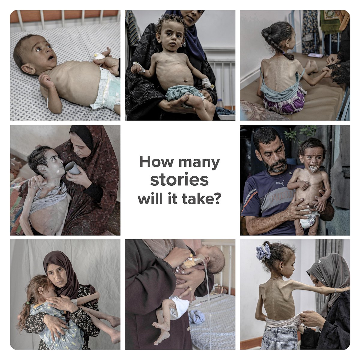 WHOoPt's tweet image. Malnutrition is on a dangerous trajectory #Gaza Strip, marked by a spike in deaths in July.
Of 74 malnutrition-related deaths in 2025, 63 occurred in July, including 24 children under five, a child over five, and 38 adults.
The crisis remains entirely preventable. Deliberate…