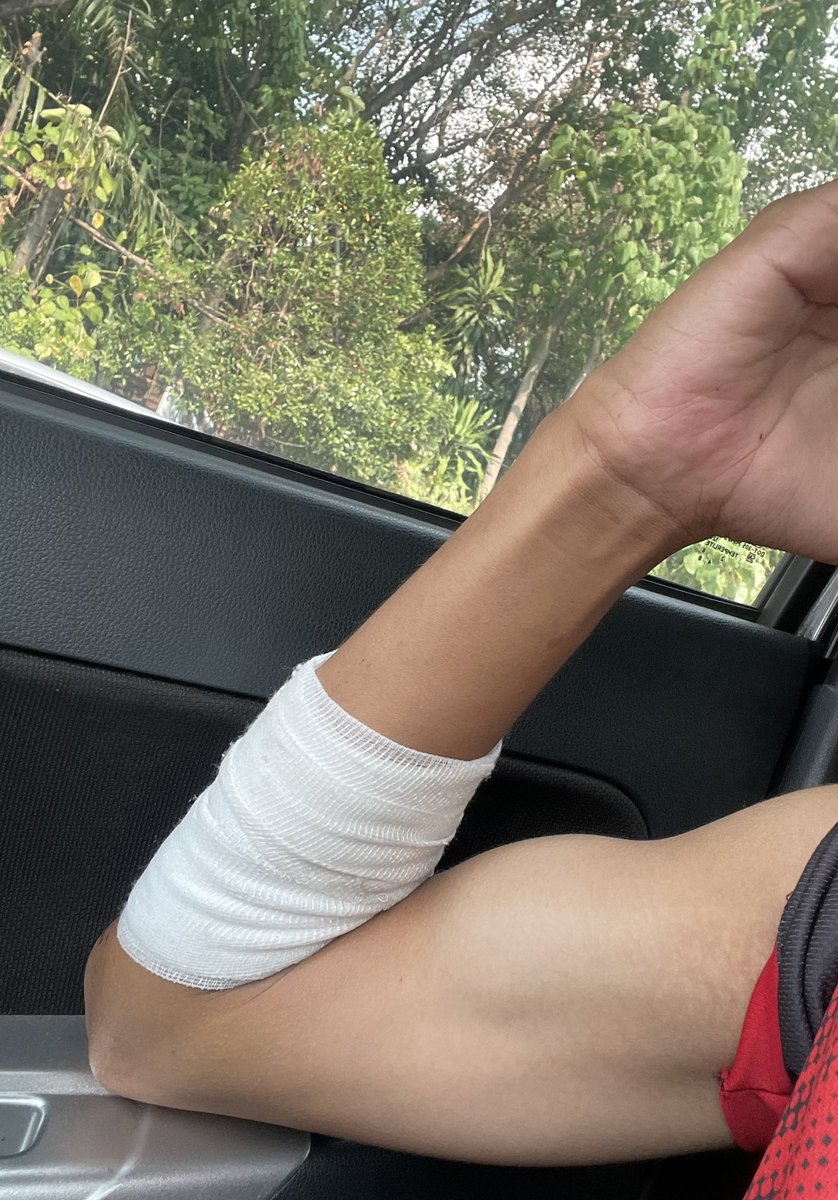 shouldtobeurs's tweet photo. injured 🤕 https://t.co/PWJjlwgkrS