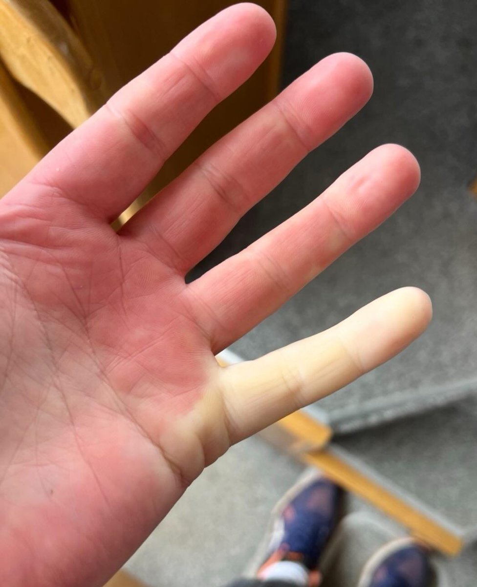 lowkeyaryaa's tweet image. One finger living in Antarctica, the rest in Mumbai