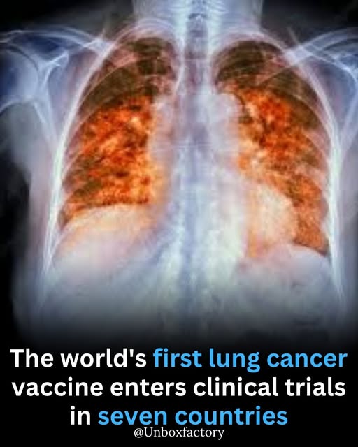 DailyHemo's tweet image. A  new vaccine designed to prevent and treat lung cancer is undergoing  clinical trials in seven countries. Developed by Cuban researchers and  named CIMAvax-EGF, the vaccine trains the immune system to target a specific protein that promotes tumor growth.