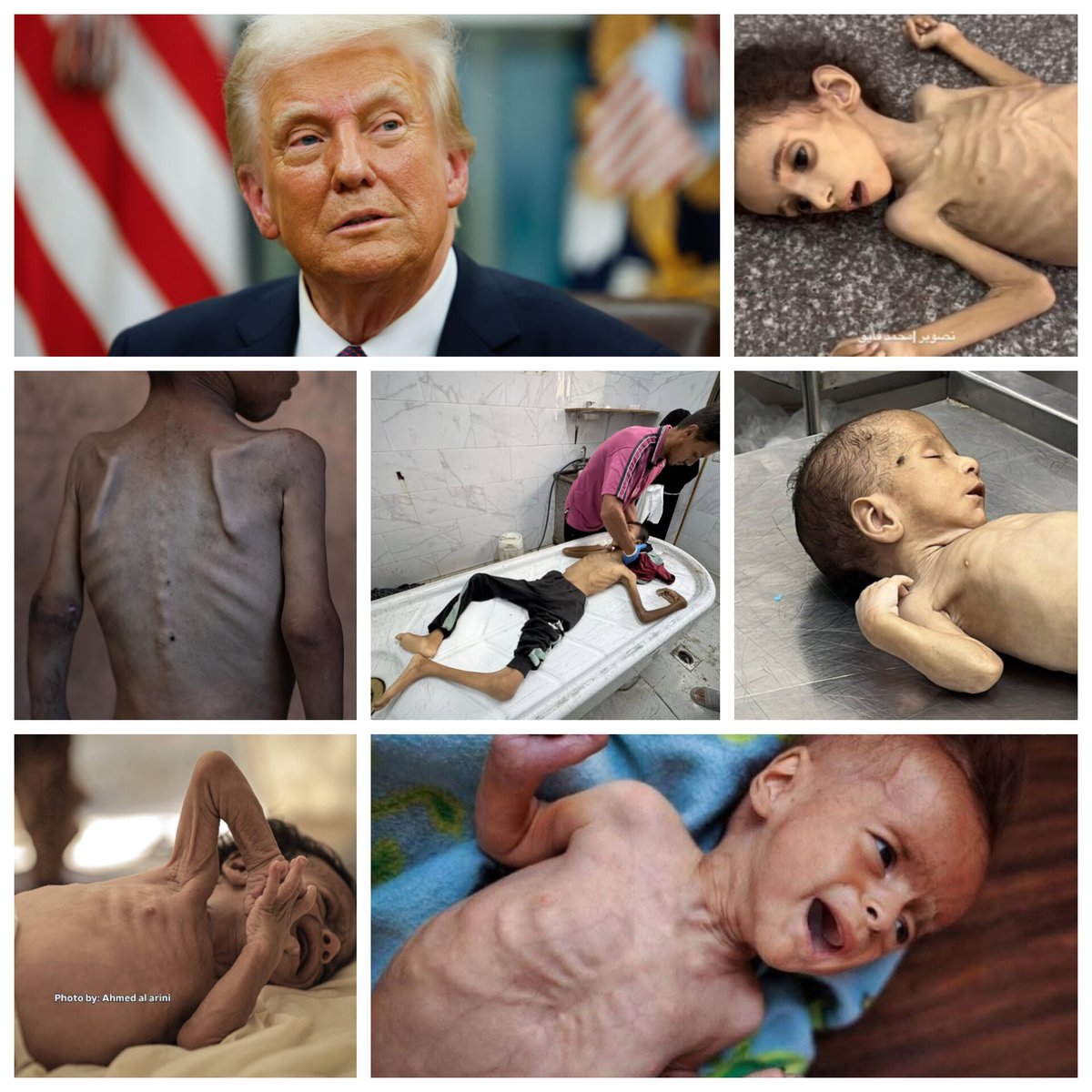 MilitantTracker's tweet image. 🚨🇺🇸🇵🇸 TRUMP SPEAKS OUT ON GAZA
▪️“TV shows it all”—Gaza’s children appear starving
▪️Calls for immediate food and safety for Gaza’s kids
▪️Tells &quot;Israel&quot;: You may need to handle this differently