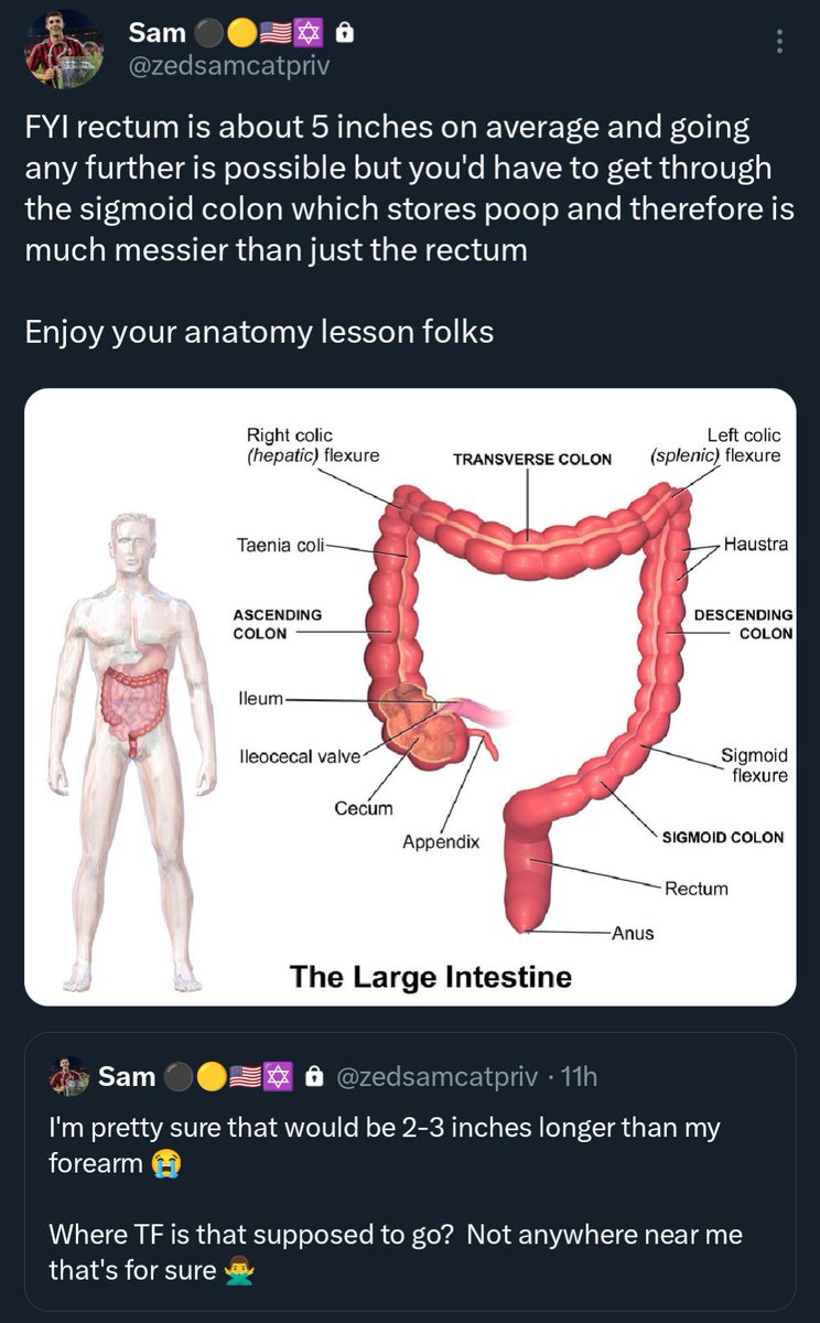 zedsamcat's tweet image. I give free anatomy lessons on the alt