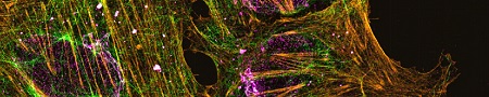 aberrior &amp; <a href="/tebubio/">Tebubio</a> : Joined Forces to Expand Access to Fluorescent  Probes in Europe  biotech-spain.com/es/articles/ab…