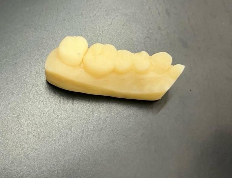 IN_WesternFleet's tweet image. Fleet Dental Centre #WesternFleet takes a tech leap with first Digital Dental Lab of #IndianNavy with intraoral scanner and 3D printing for crown 🦷fabrication.
#GameChanger reducing chair side time for deployed personnel.
@indiannavy
@IN_WNC
@DefPROMumbai