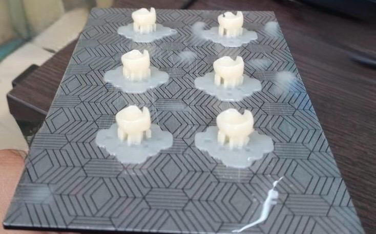 IN_WesternFleet's tweet image. Fleet Dental Centre #WesternFleet takes a tech leap with first Digital Dental Lab of #IndianNavy with intraoral scanner and 3D printing for crown 🦷fabrication.
#GameChanger reducing chair side time for deployed personnel.
@indiannavy
@IN_WNC
@DefPROMumbai