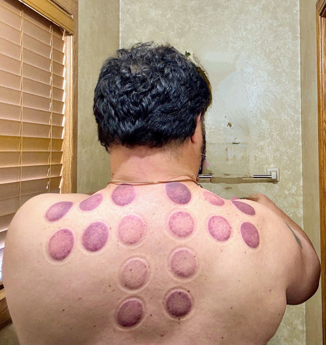 Elite athletes require elite physical therapy to compete. 
You know me better than that!
This is actually for a pinched nerve in my upper back/neck. 
The only thing I train for is Irish Car B💣mbs &amp; White Castle 20 racks 
This pinched nerve shit ain’t no joke. Big pain!!