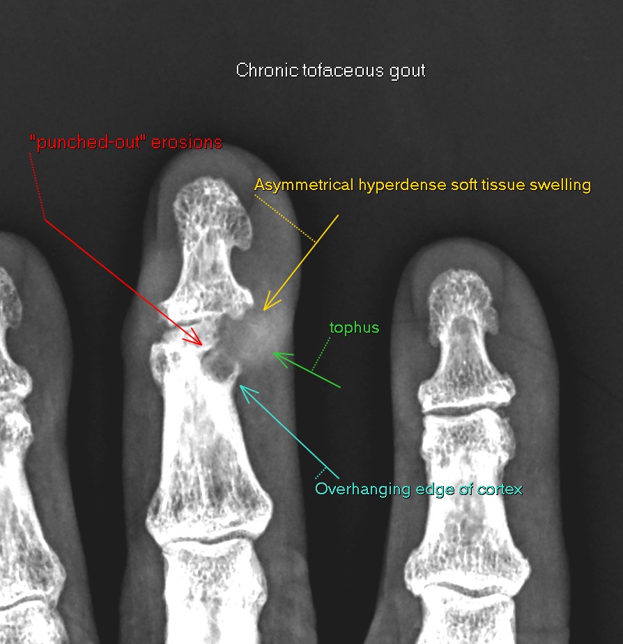 JuanMiranda tweet media