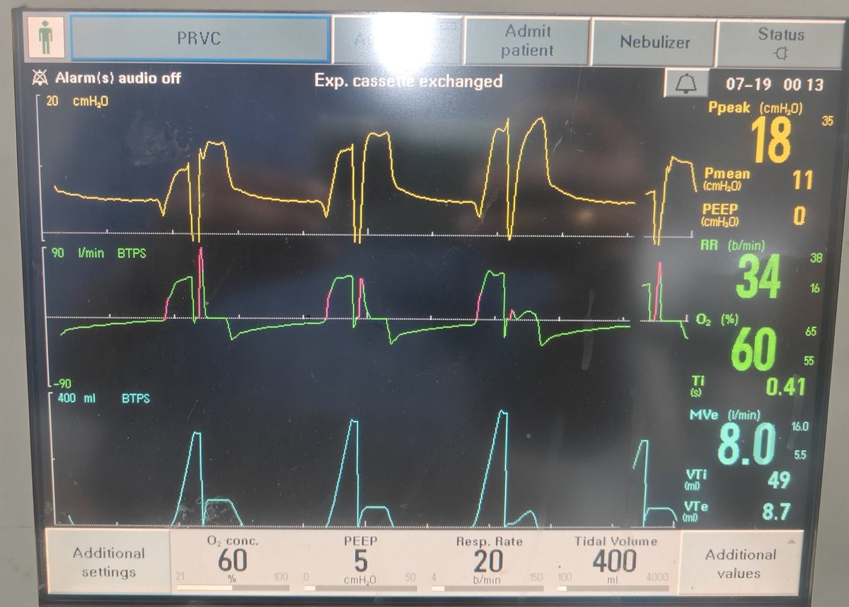 How would you interpret these waveforms?