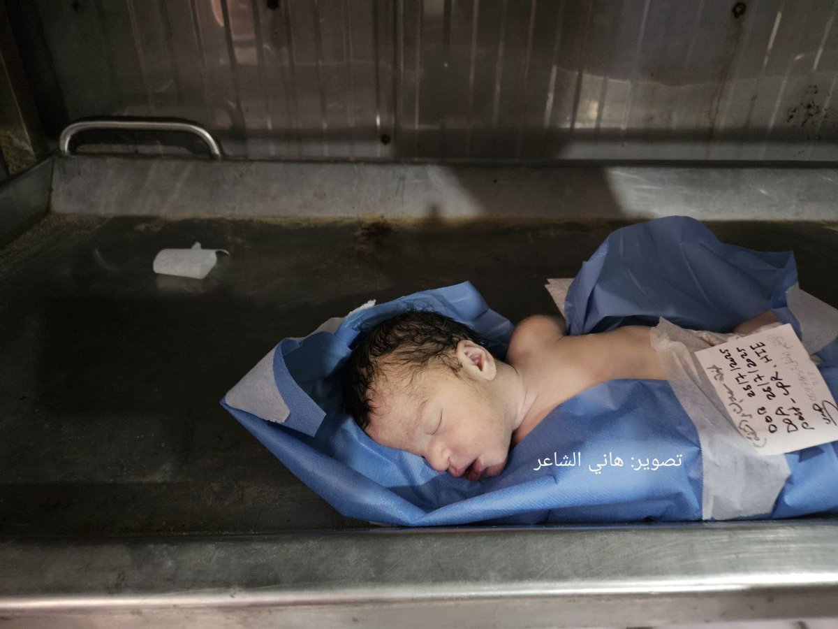MilitantTracker's tweet image. 🚨🇵🇸 Occupied Palestine – Gaza Bleeds Again
▪️ Al-Nuseirat: 7 martyred, 22 injured as Israeli forces strike a crowd near aid point on Salah al-Din St.
▪️ Sheikh Radwan: 1 martyr, multiple injured in Israeli shelling of residential apartment.
▪️ Hakr, Deir al-Balah: New injuries…