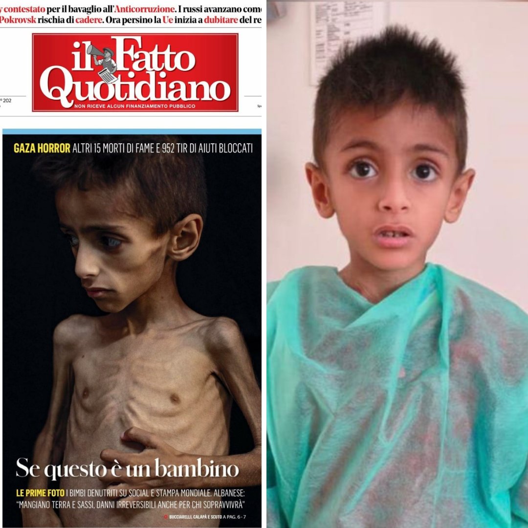 IsraelinSpanish's tweet image. Una mentira que se propaga más rápido que la verdad:
Este niño es Osama al-Raqab, de 5 años. Padece fibrosis quística, una grave enfermedad genética.
El 12 de junio, Israel facilitó su traslado médico desde Gaza y actualmente está en Italia recibiendo tratamiento.
Pero eso no…