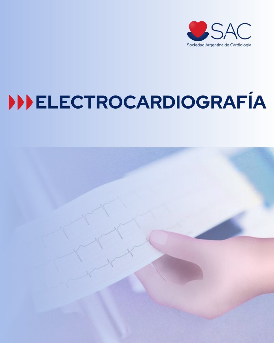 SAC_54's tweet image. 🔵Curso de Electrocardiografía 📣¡Abierta la inscripción!

🔺Desarrollar las habilidades para interpretar un ECG normal y patológico. Diagnosticar patologías del sistema de conducción, bradi y taquiarritmias.

📌Inicio: 4 de agosto  

¡No te quedes afuera!

✅Más información 👉🔗…