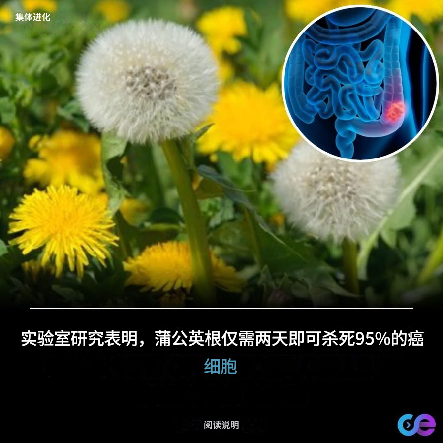 edisoncomeon's tweet photo. 加拿大研究人员的一项惊人发现表明，蒲公英根提取物可以在 48 小时内杀死高达 95% 的癌细胞（特别是白血病和结肠癌细胞），同时不会伤害健康细胞
这种草药提取物能够诱导癌细胞凋亡，即程序性细胞死亡，且不会产生化疗等毒副作用。目前，该提取物正在进行进一步的临床研究 https://t.co/hdXqA0VD3s