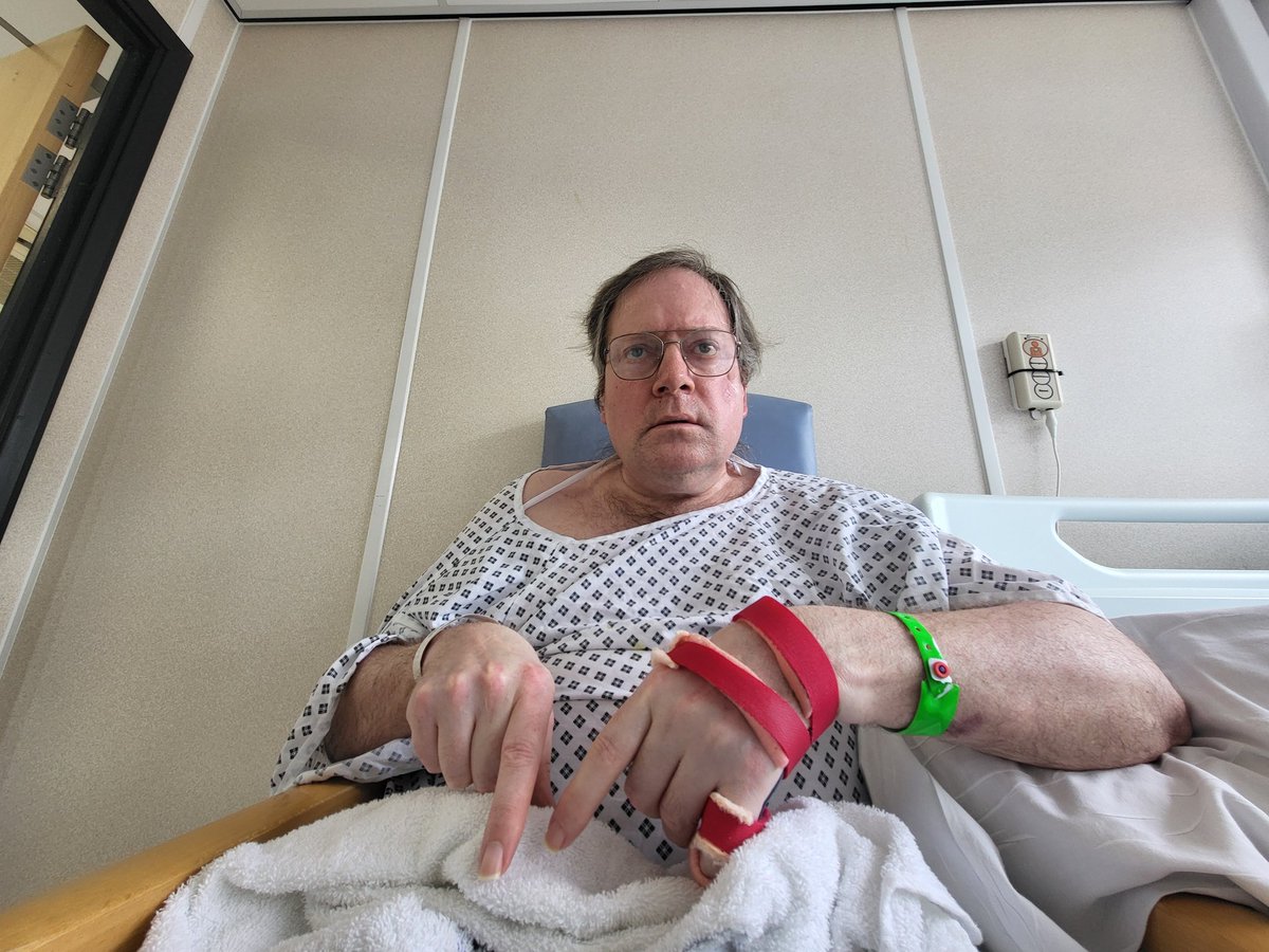 TimmyUk's tweet image. ... my knee wound today wearing my excellent glasses watching sloth movie on SkyGo in sideroom in hospital ... ๐ฅ ๐ ๐ง ๐ฑ ๐ผ ๐คณ ๐ฐ ๐ก ๐ฆฅ ๐ฌ ๐ ๐ฅ ๐ซ