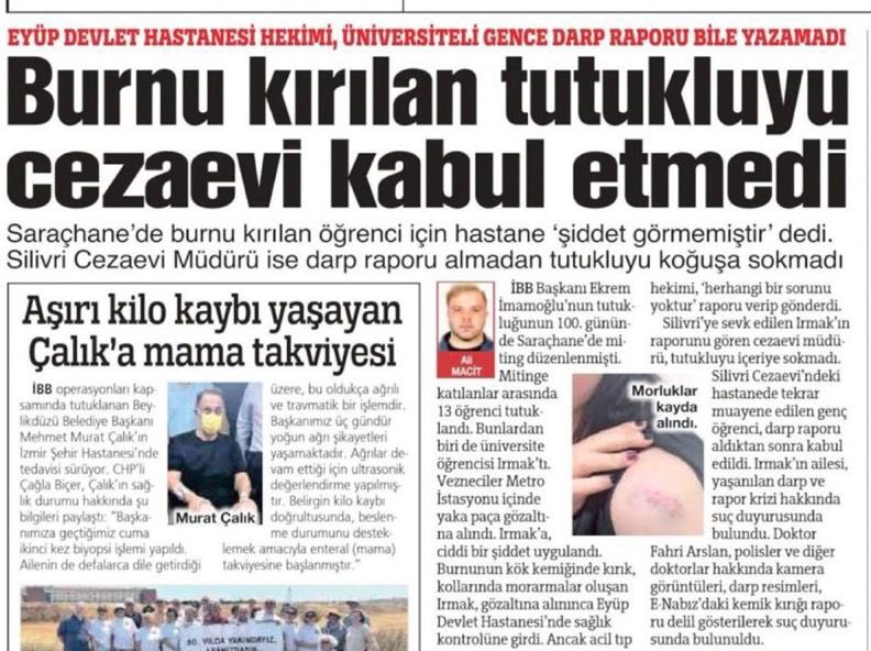 wys9h's tweet image. inisiyatifinize kalmis keyfi kararlarla piril piril bi genci TUTUKLAMANIZ yetmiyormus gibi 3 kere gectikleri hastane kontrollerinin hicbirinde acik iz ve belirtiler olmasina ragmen darp raporu vermediniz. yuzum agriyor diye sayiklayip durdu 3 gun. hadi yandassiniz, elinizi…