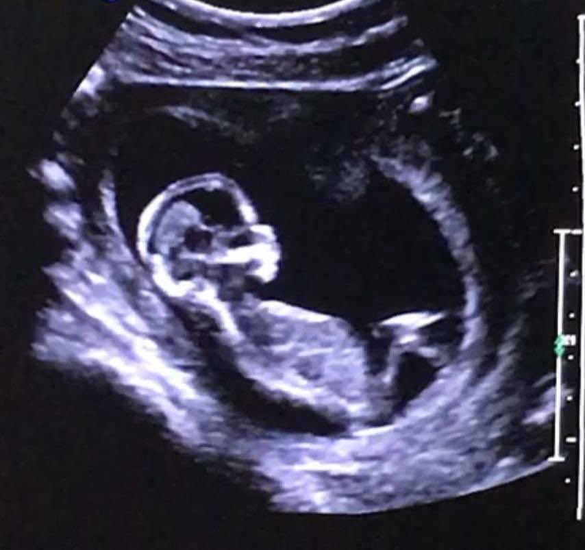 CUIDADO DESDE EL MOMENTO EN QUE COMIENZA LA VIDA HUMANA

La Ciudad implementó un nuevo protocolo de acompañamiento a embarazadas que asiste y protege a mujeres y a sus hijos durante los primeros 1000 días de vida. 

Se trata de una etapa fundamental y delicada en la vida, que