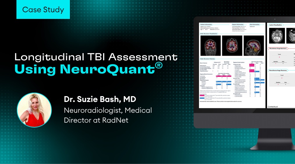 🧠 New Case Study Alert!

In this powerful case study with Dr. Suzie Bash at RadNet, we explore the longitudinal imaging of a 71-year-old patient with a history of repeated head trauma. 

This case highlights how NeuroQuant® TBI can: 
• Detect subtle post-traumatic changes
•