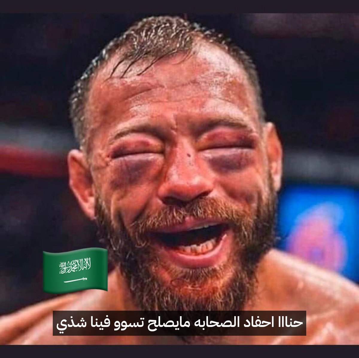 احلى حاجة شغالة في تركيا🇹🇷 دلوقتي إن الأتراك ماسكين السعوديين🇸🇦 ومسحوا بيهم الأرض مسح، أهانوهم وعروهم من كرامتهم، دعس وفضايح وإهانة قدام الخلق، الأتراك فعلاً وروهم حجمهم الحقيقي 🇸🇦👢