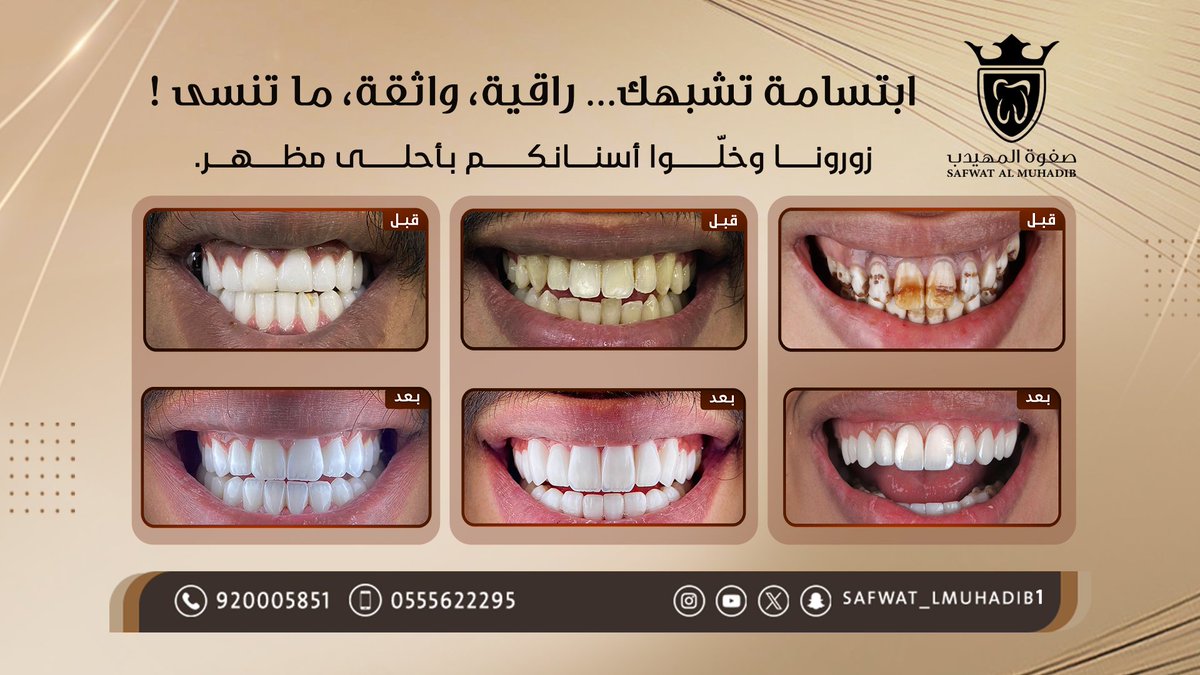 Safwat_lmuhadib's tweet image. ابتسامة تشبهك … راقية، واثقة، ما تنسى !
✨ بتقنياتنا الحديثة وخبرة أطبائنا، نخلي ابتسامتك تنطق جمال وثقة.
📍 احجز استشارتك الآن في أقرب فرع لك.
💳تقسيط متاح عبر تابي وتمارا
📞920005851 - 0555622295
رابط الحجز المباشر :
almuhadeb-lp.com/x
#ابتسامة_هوليوود…