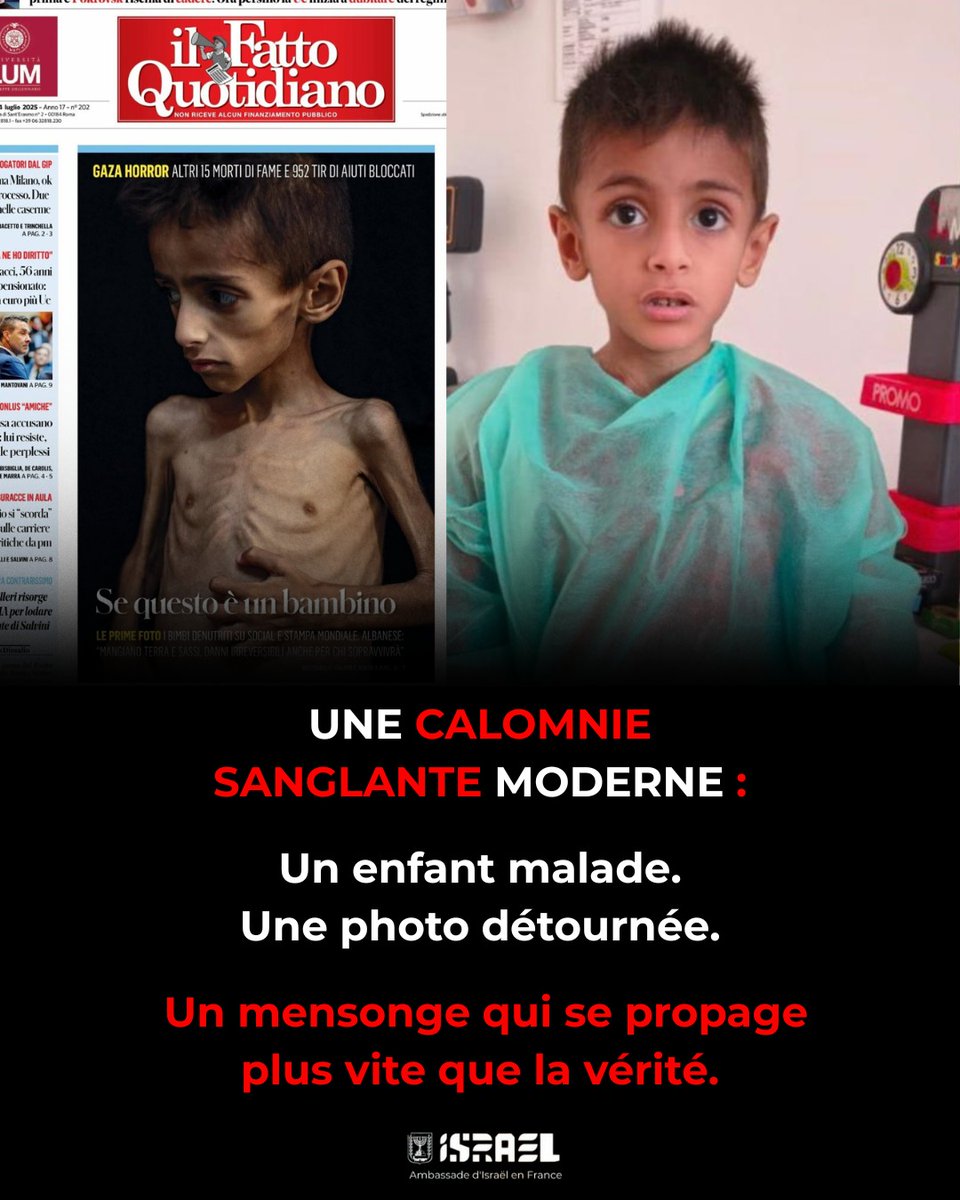 Voilà à quoi ressemble une calomnie sanglante moderne :

Un enfant malade. Une photo détournée. Un mensonge qui se propage plus vite que la vérité.

Il s’appelle Osama al-Raqab. Il est atteint de mucoviscidose, une maladie génétique grave.

Il est soigné en Italie depuis le 12
