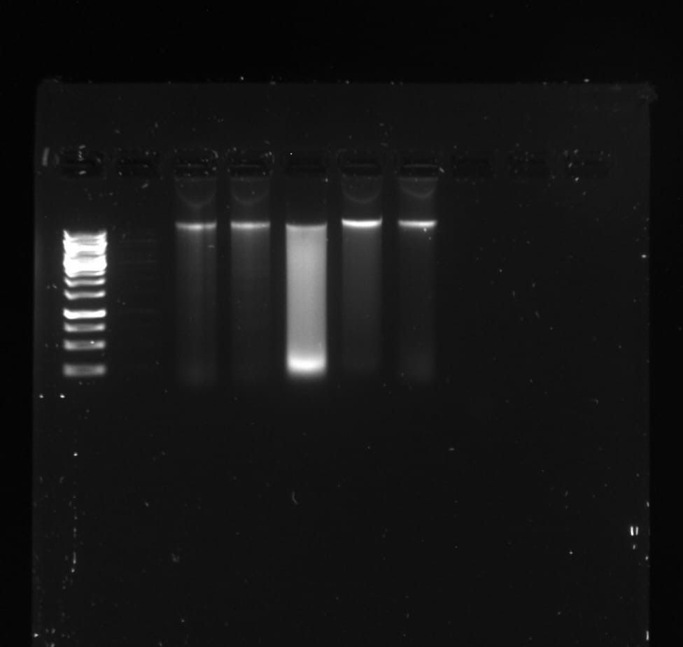 SciencesNCL's tweet image. 🧬 After extracting DNA from water samples, Mia checked quality via gel electrophoresis—success! The 16S region was intact. Now she is running Nanopore sequencing to ID bacteria &amp;amp; explore microbial diversity. Results coming soon… stay tuned! #EnvironmentalMicrobiology #WeAreNCL