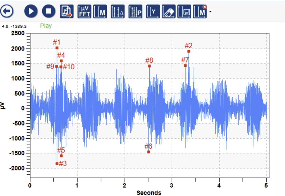 #SlowSpeed machines can hide big problems.
In this case study, the SDT340 detected a misaligned sprocket via periodic ultrasound spikes—missed by other tech. Realignment fixed the issue instantly.
Ultrasound makes slow-speed diagnostics simple.
Read more: linkedin.com/pulse/identify…