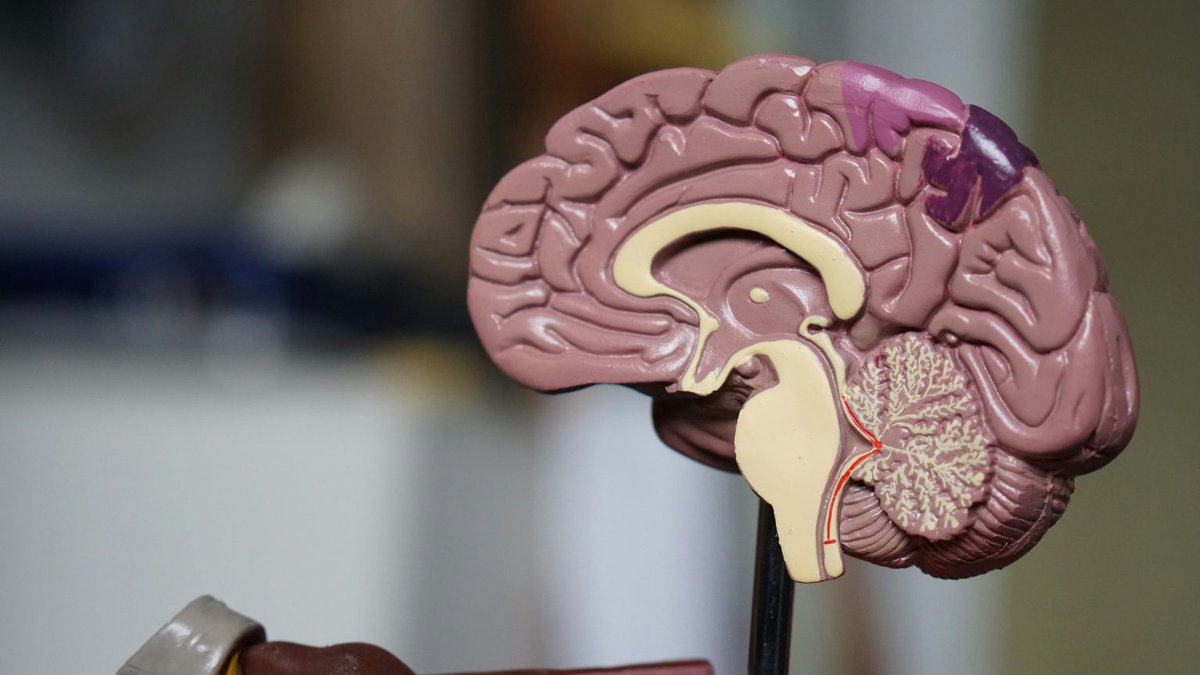 Younger patients face longer delays in dementia diagnosis, research shows
<a href="/ucl/">UCL</a> #europe #unitedstates #australia #china #highincomecountries #universitycollegelondon #internationaljournalofgeriatricpsychiatry #dementiacommunity #earlyonsetdementia #frontotemporaldementia