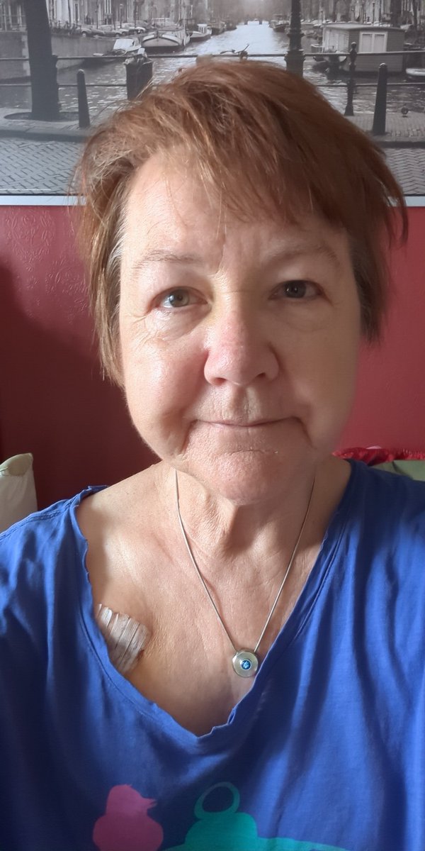 Almost a week since pacemaker installed. Feel like I've aged 30 years. Feel like a fragile rose, will get used to faster heart beat, but light headedness is a question I'll ask GP this afternoon. Going to attempt to walk few blocks to them, so send good vines thru' the airwaves