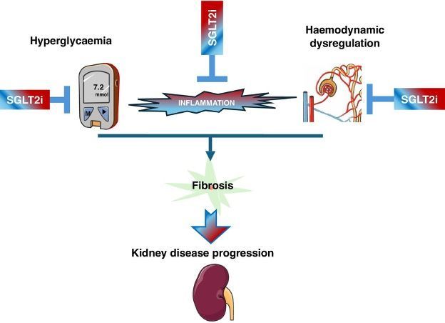 AIN (@nephrosage) on Twitter photo Still thinking about stopping SGLT2i in AKI? How about starting it in the critically ill?
More info: academic.oup.com/ndt/article/40… and jamanetwork.com/journals/jama/…
<a href="/NDTsocial/">NDT</a>, <a href="/vinckcaro/">Caroline Vinck</a>, <a href="/hjanders_hans/">Hans-Joachim Anders</a>, <a href="/ERAkidney/">ERA - European Renal Association</a> Still thinking about stopping SGLT2i in AKI? How about starting it in the critically ill?
More info: academic.oup.com/ndt/article/40… and jamanetwork.com/journals/jama/…
<a href="/NDTsocial/">NDT</a>, <a href="/vinckcaro/">Caroline Vinck</a>, <a href="/hjanders_hans/">Hans-Joachim Anders</a>, <a href="/ERAkidney/">ERA - European Renal Association</a>