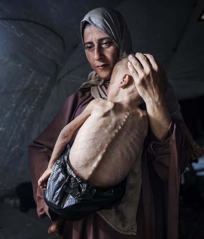 bobbykhan54's tweet photo. I stand with palestine 

#Gaza #Genocide #Palestine 

Starving Children in Gaza Face Catastrophic Hunger Crisis Amid Ongoing Conflict https://t.co/ssWsvzdSkq