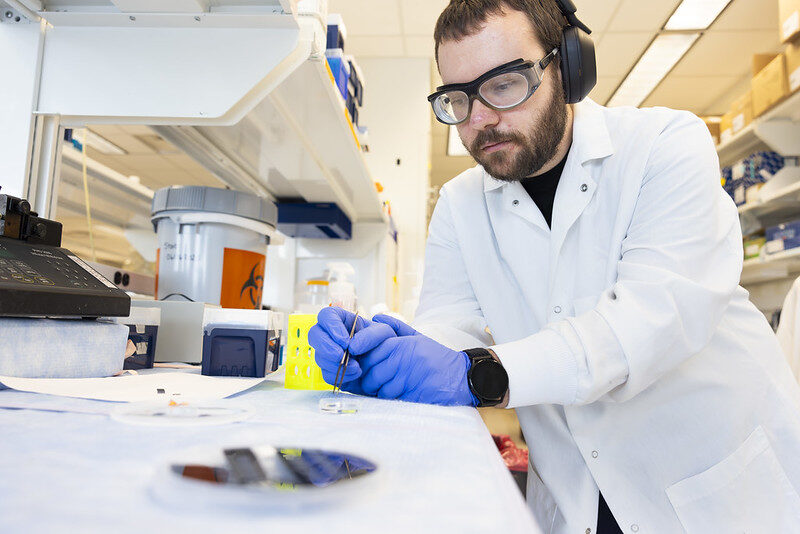 UMichResearch's tweet image. .@UMich researchers have developed a skin patch and test strip that could lead to at-home melanoma testing. myumi.ch/z9Mxw